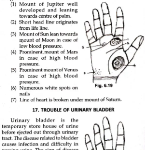 Diagnosis of Disease by Palmistry and Numerology 1