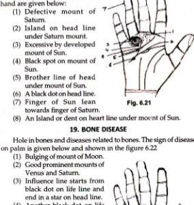Diagnosis of Disease by Palmistry and Numerology 2