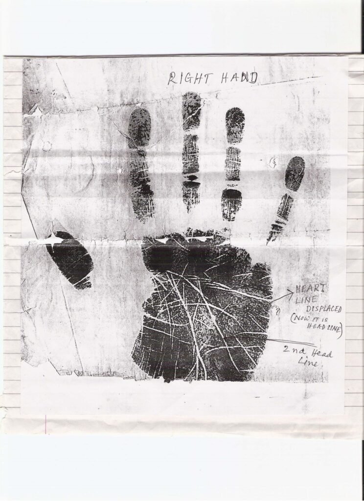 Examination of Lines Between Right and Left Hands – A Study E.S. Krishnan 2 Examination of Lines Between Right and Left Hands – A Study 2